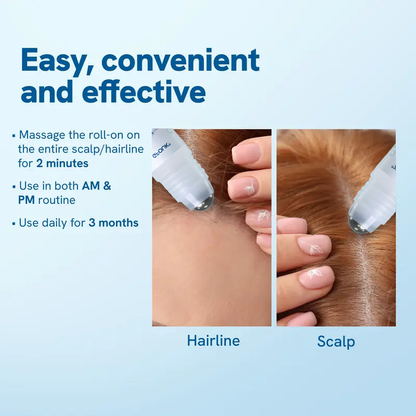 Hair Growth Roll-On Serum – See hair growth in 4 weeks