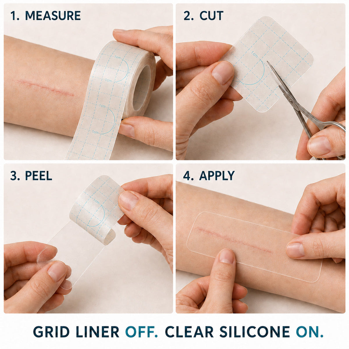 💞👩‍⚕️TRILUMIA® SILICONE SCAR THERAPY ROLL  Help Soften, Flatten & Improve the Appearance of Raised Scars