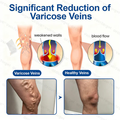 💞🪐GFOUK® VeinTarget Microneedle Patch⚡Instant Relief, Long-Term Results