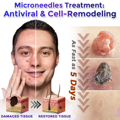 💞☘️Celsiora® Multi-Functional Microneedle Hydrocolloid Patch Roll | Targets Skin Tags, Warts & Stubborn Blemishes