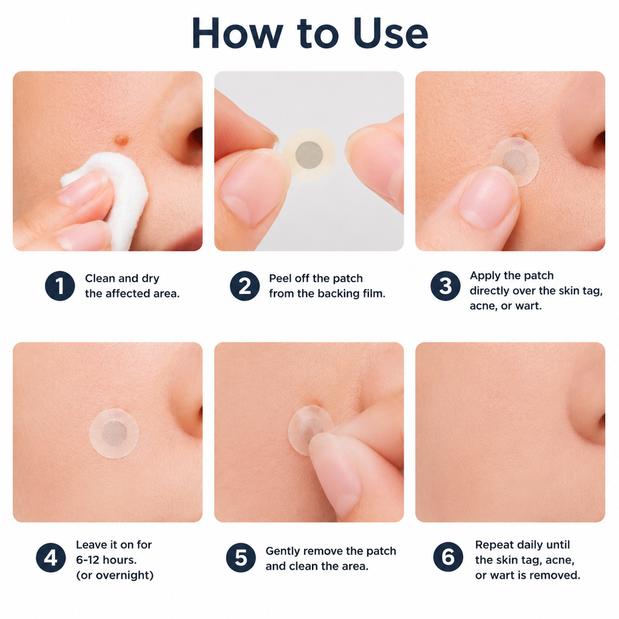 ✅Trilumia®2-in-1 Microneedle & Hydrocolloid Patch💫| Removes Raised Moles, Acne, Flat Warts & Skin Tags | Helps Improve Wrinkles, Scars & Blemishes | Invisible Patches for Face & Body