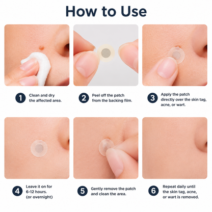 ✅Trilumia®2-in-1 Microneedle & Hydrocolloid Patch💫| Removes Raised Moles, Acne, Flat Warts & Skin Tags | Helps Improve Wrinkles, Scars & Blemishes | Invisible Patches for Face & Body